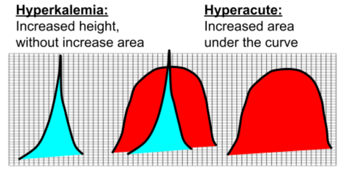 Hyper-K vs. HTW