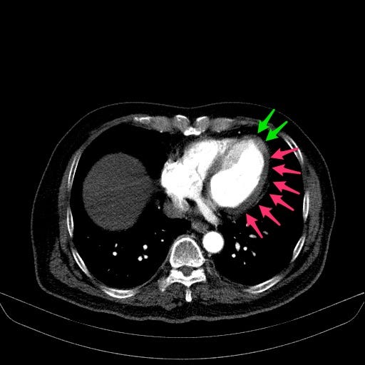 Static image of Chest CTA