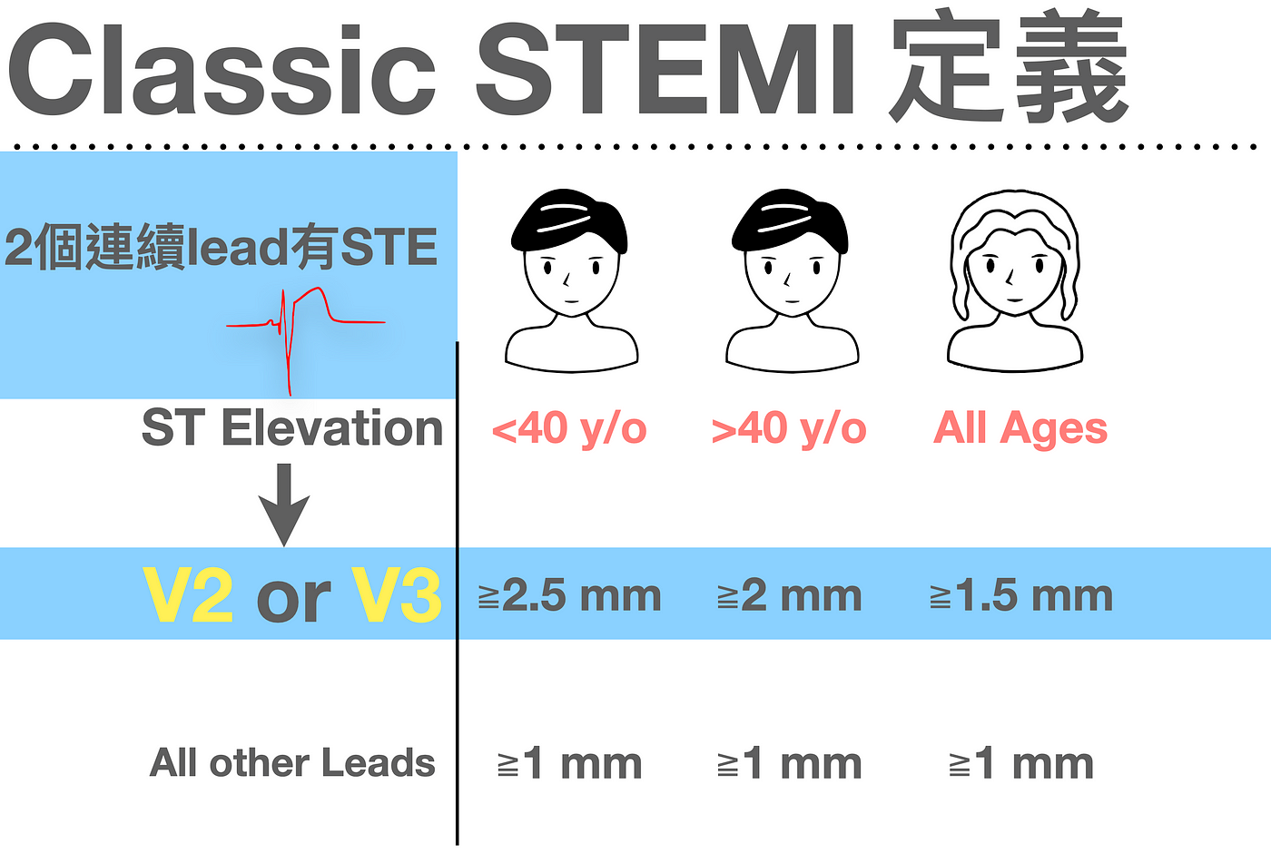 STEMI criteria