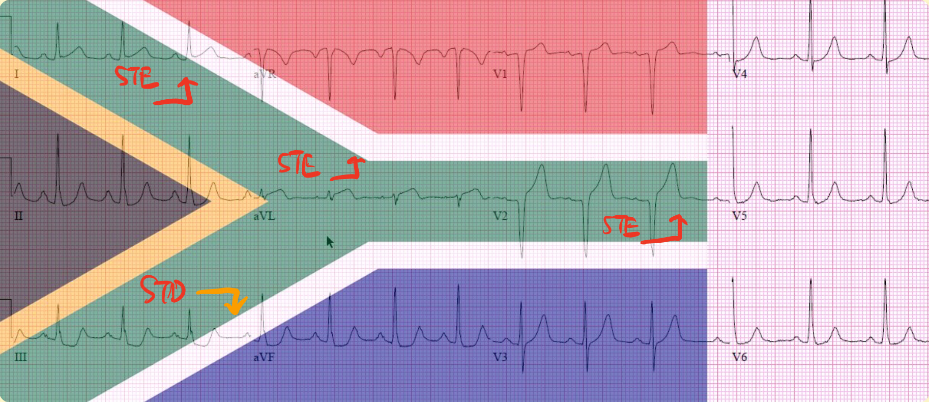 South African flag sign