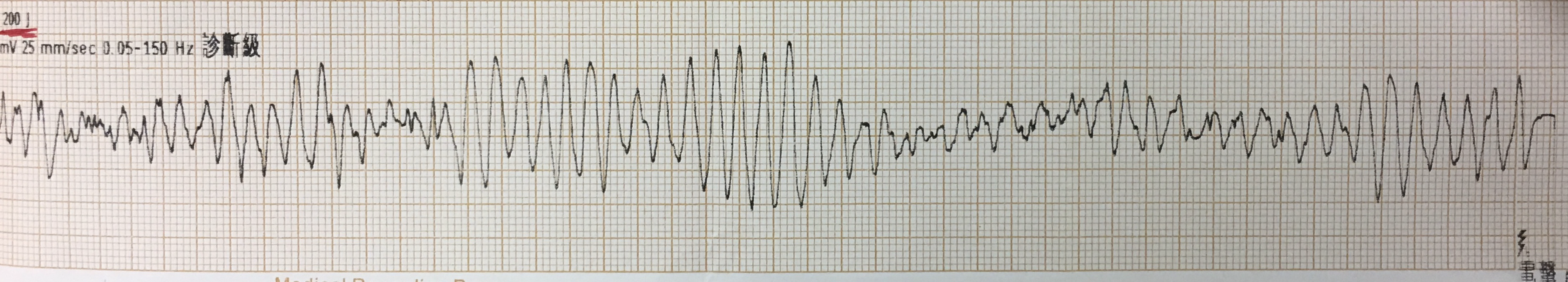 Polymorphic VT or Vf?