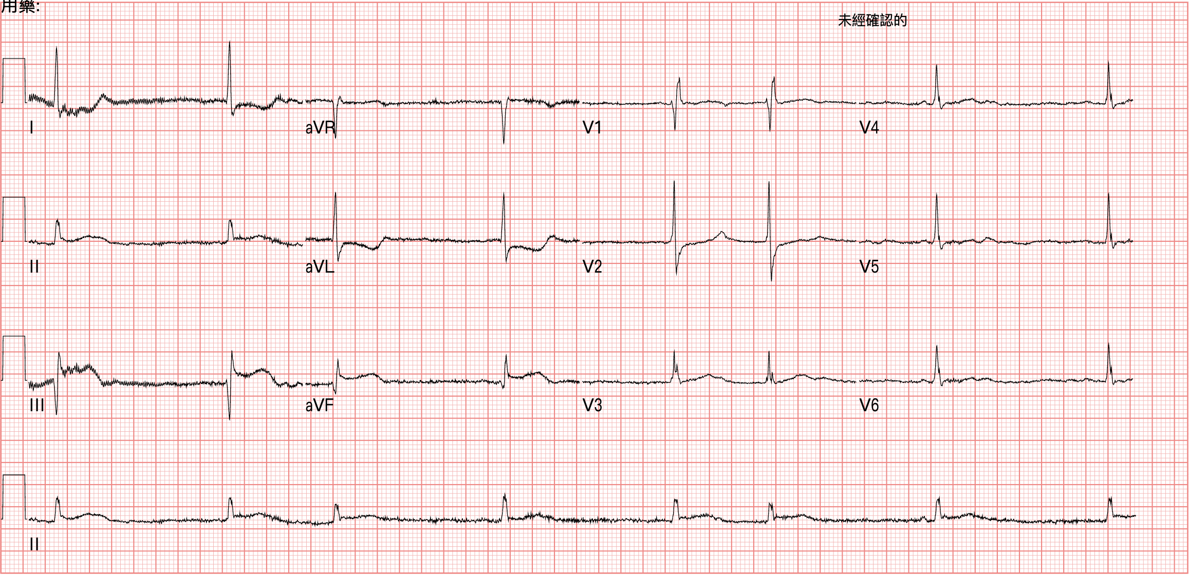 到院時ECG