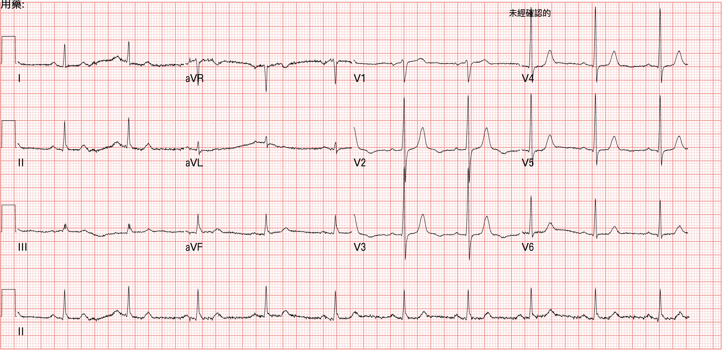再次返診+30分鐘