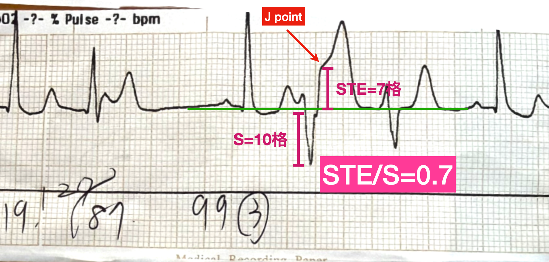CleanShot 2026-03-02 at 12.27.56@2x