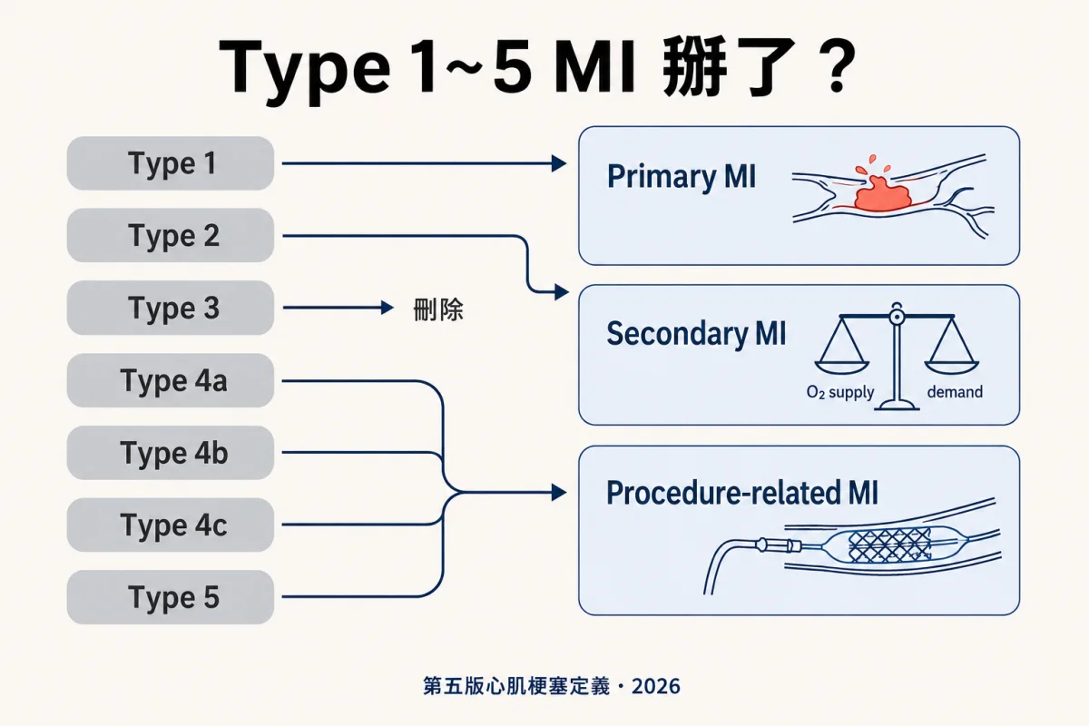 Type 1~5 MI掰了？第五版心肌梗塞定義，X.com上的大家在吵什麼？