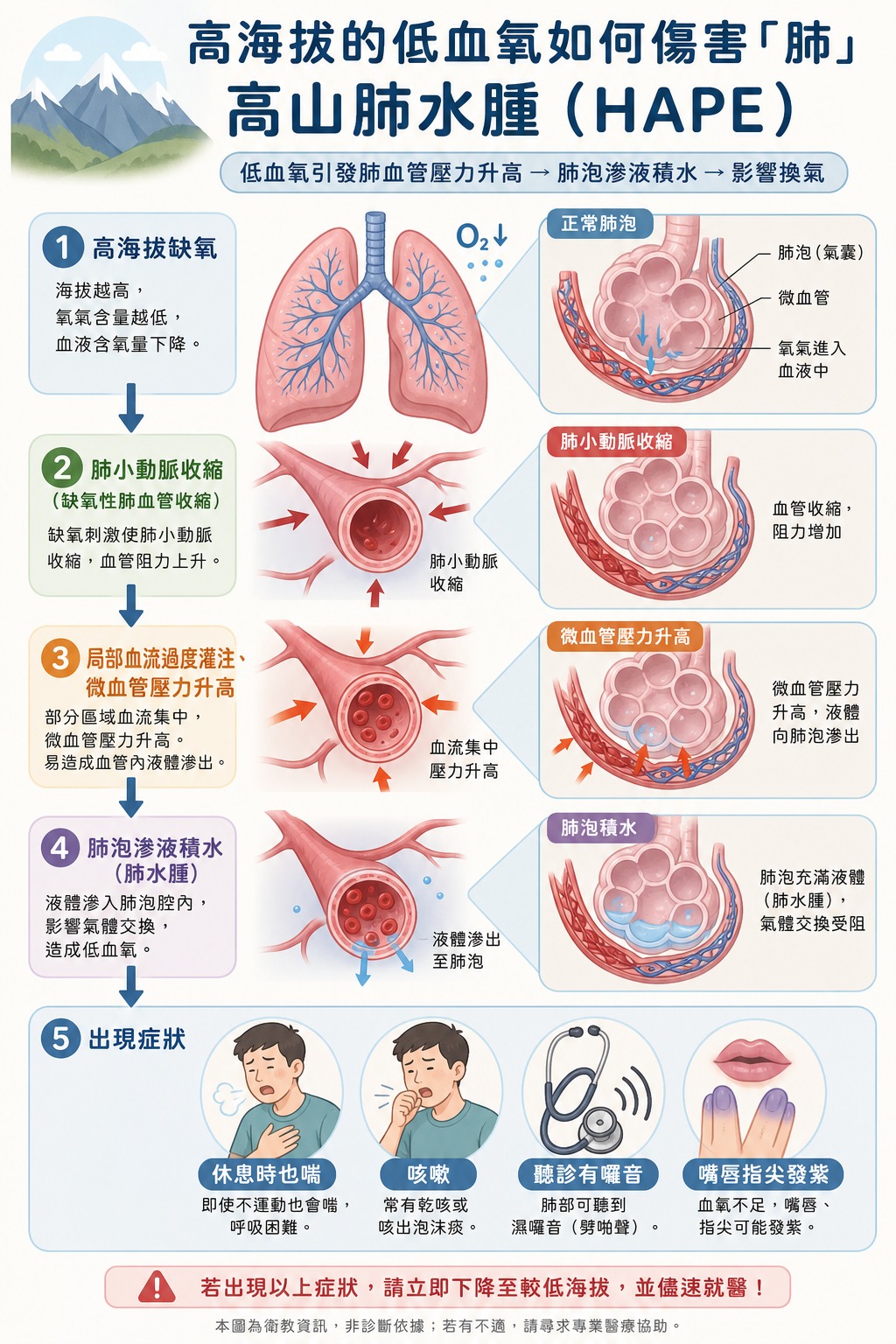低血氧如何傷肺：高山肺水腫 HAPE