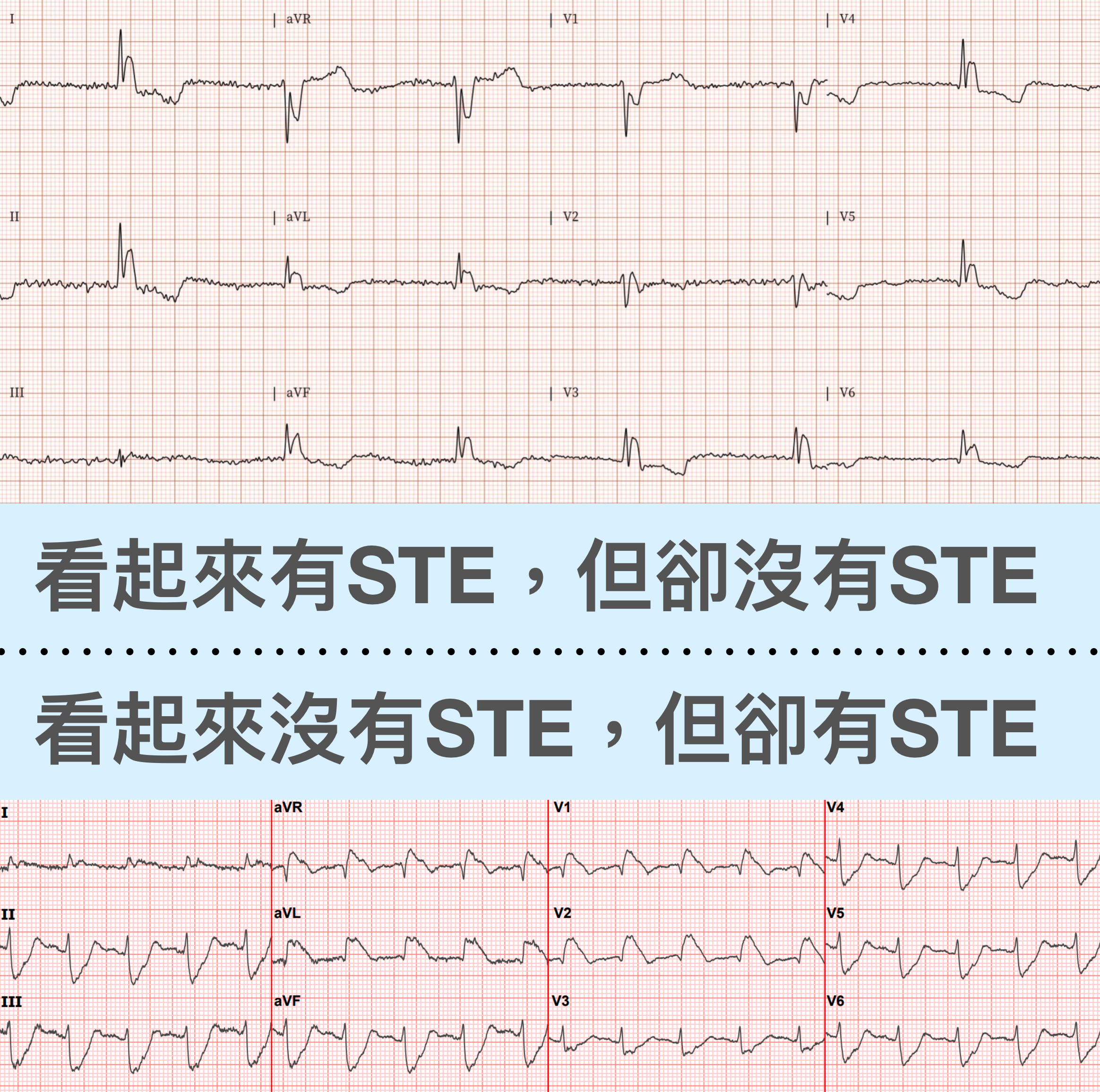 兩個個案，不同命運