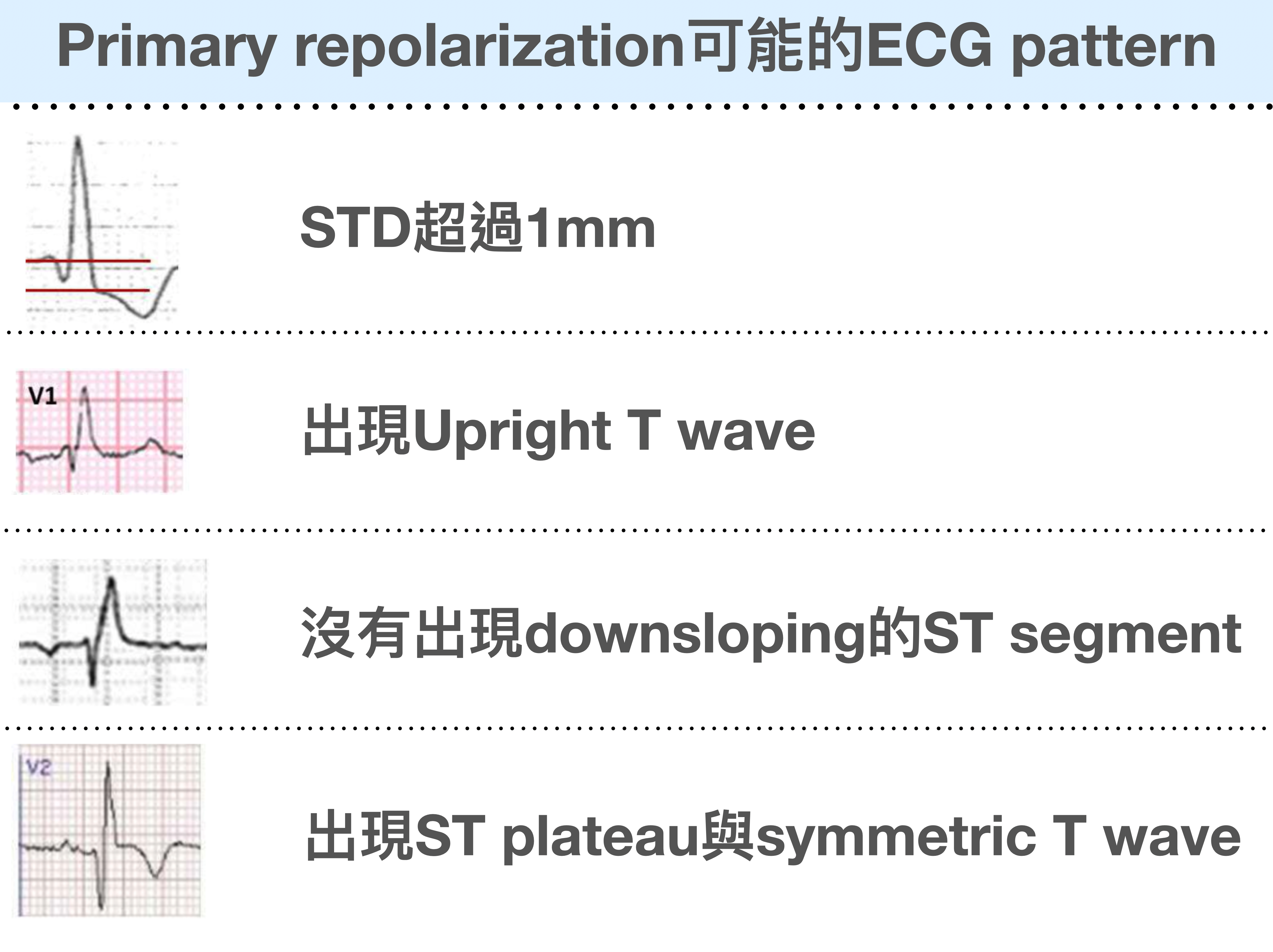 Primary repolarization異常變化