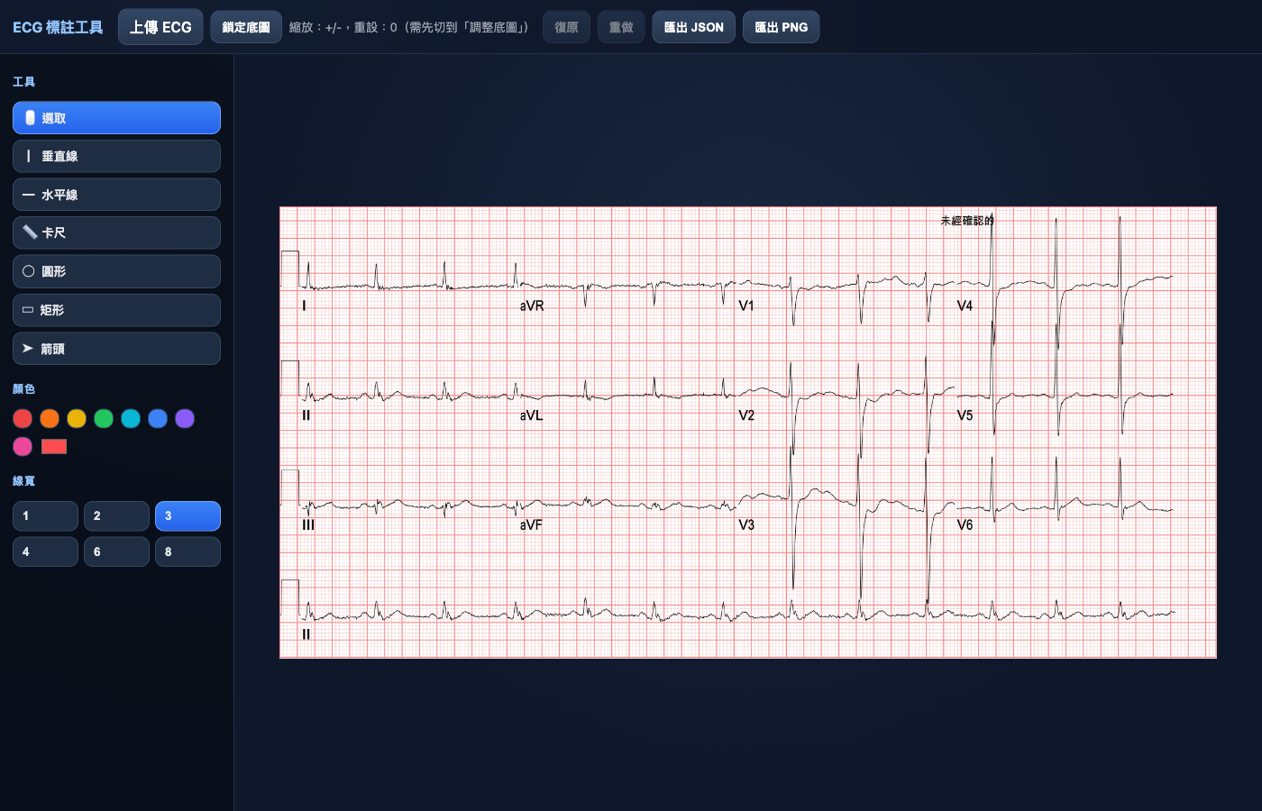 ECG 影像標註工具 預覽圖