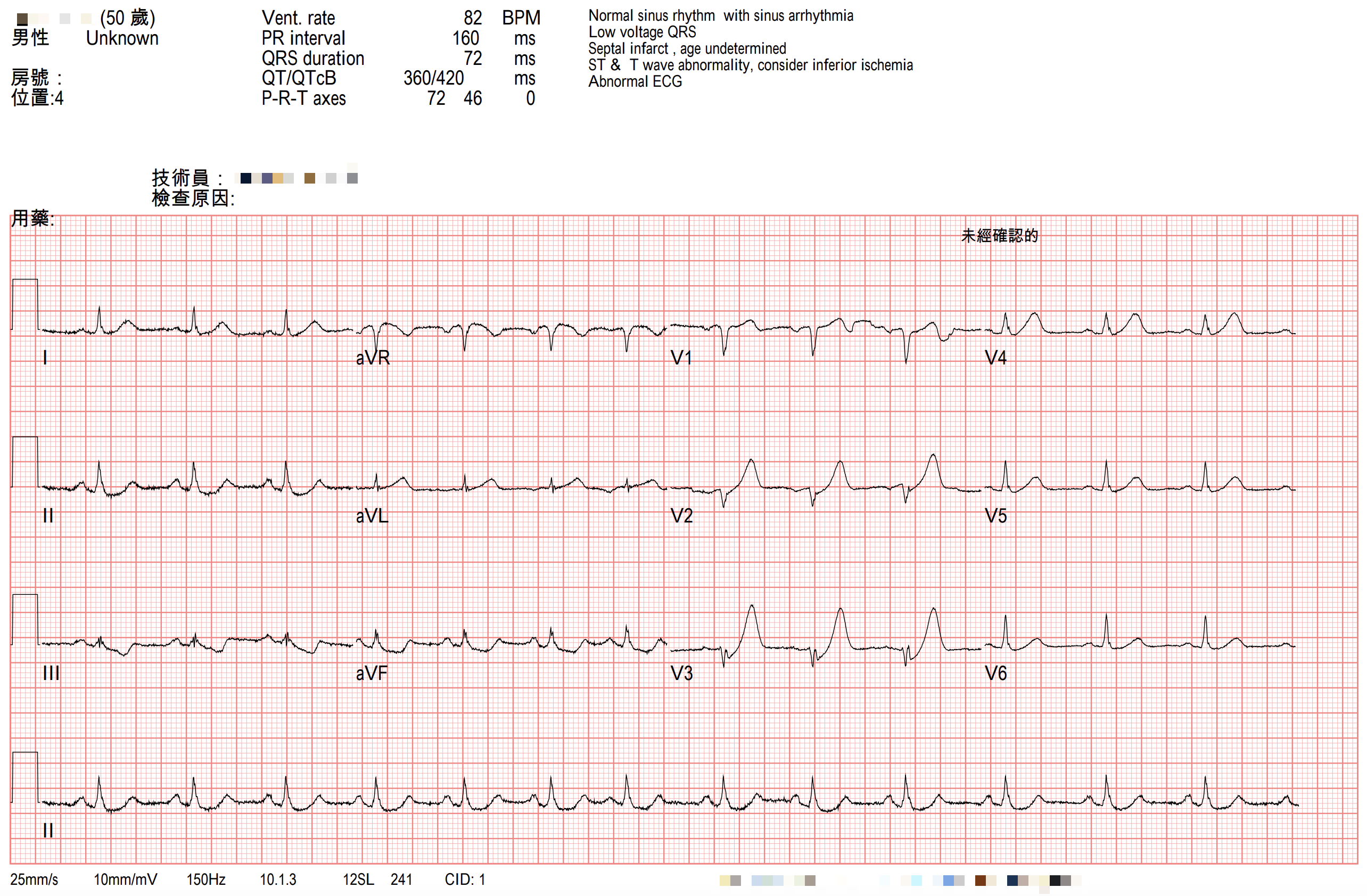 到院ECG