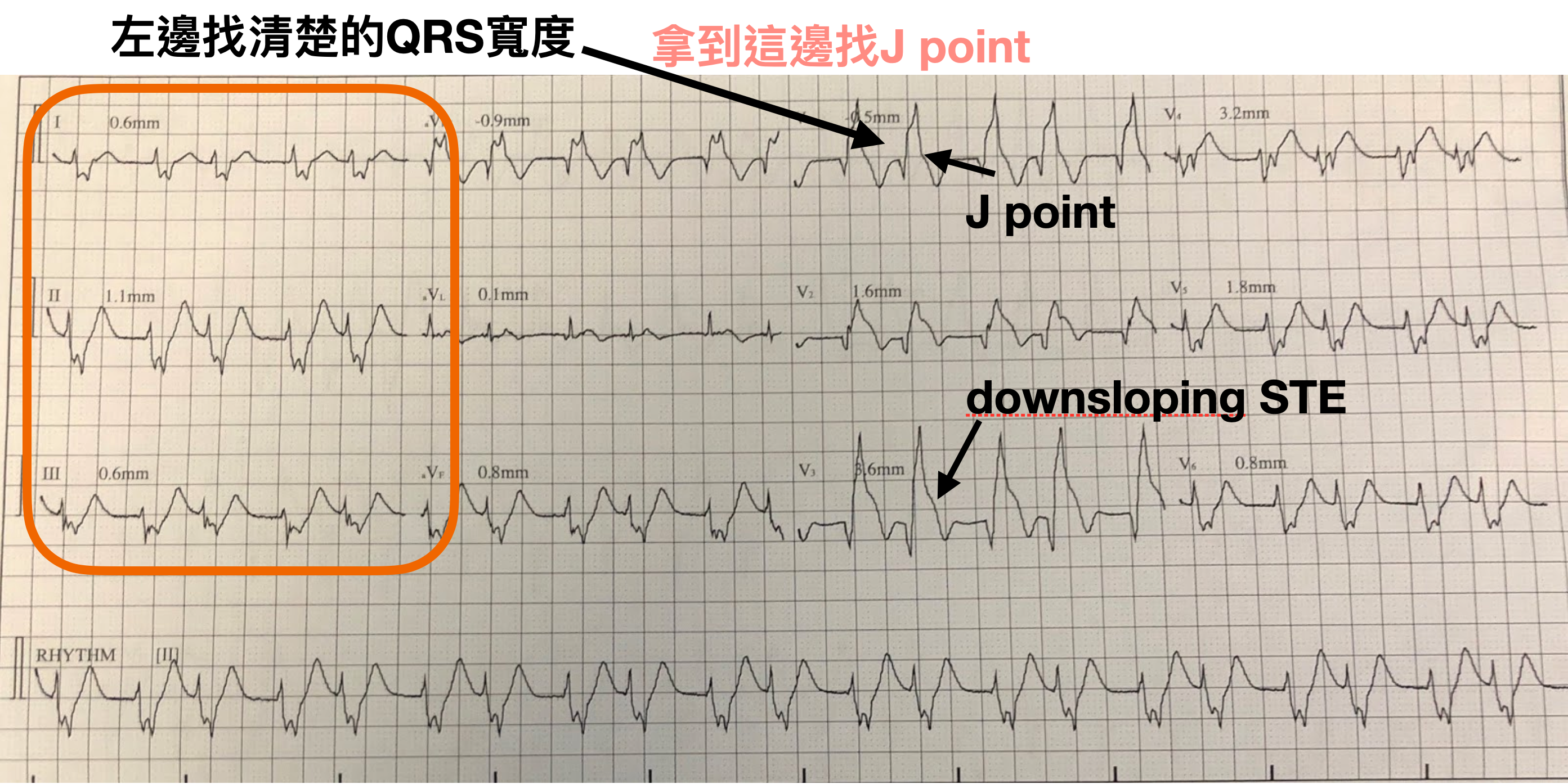 解決辦法